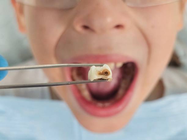Best Emergency Gum Treatment in Raven, VA